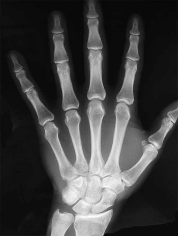 handxray handxray